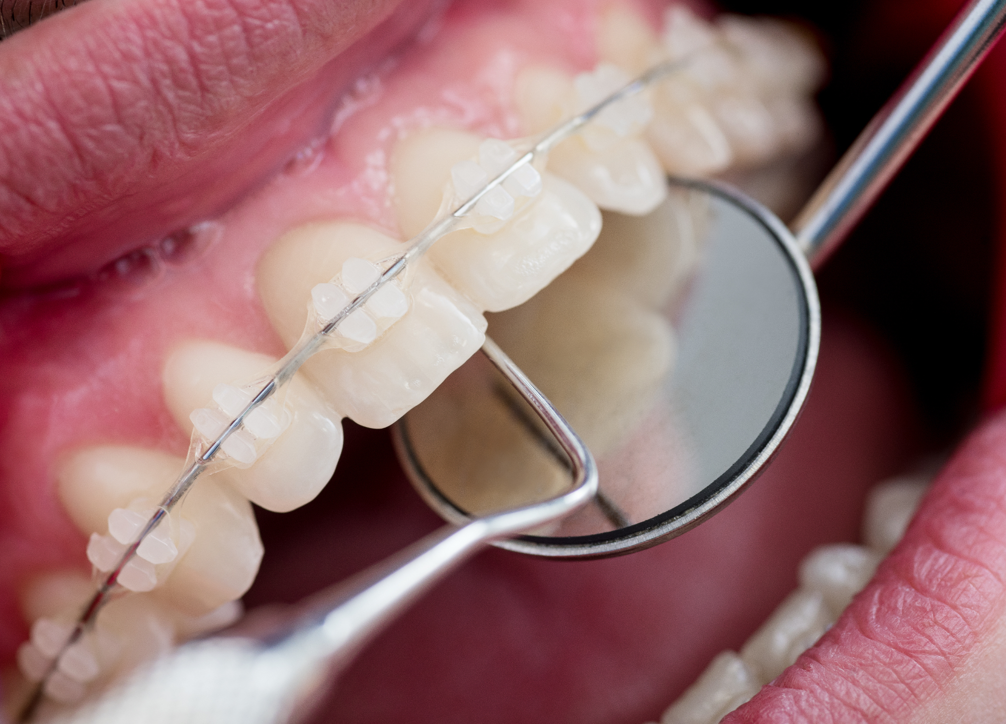 Kdaj v vaše življenje vstopi ortodont?